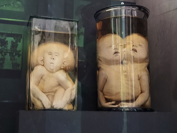 Петербурженка сильно расстроилась из-за отсутствия &laquo;уродцев&raquo; в Кунсткамере